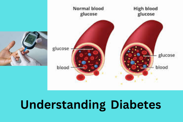 understanding diabetes,causes,symptoms,treatment and dietry guidelines